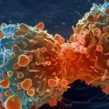 M&aacute;s de ocho millones y medio de personas mueren por c&aacute;ncer anualmente 