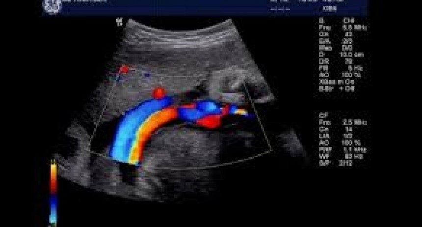 El Cullen efectuar&aacute; estudios card&iacute;acos in&eacute;ditos en Santa Fe
