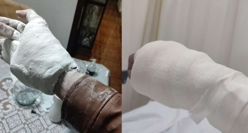 Un hombre no se puede sacar la campera porque le enyesaron la mano