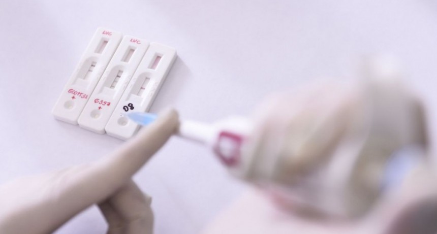 Bioqu&iacute;micos indican que el autotesteo puede llevar a que casos de covid no sean registrados