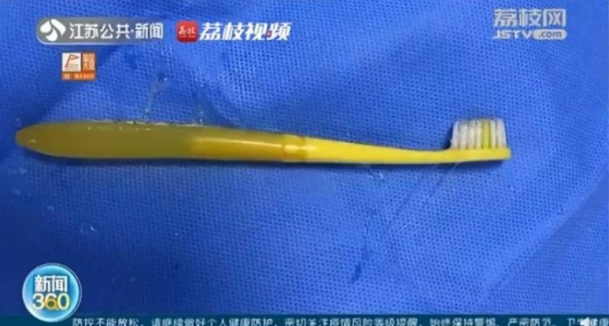 Un hombre se trag&oacute; un cepillo de dientes en China