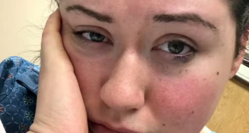 Mujer asegura que es al&eacute;rgica a la gravedad