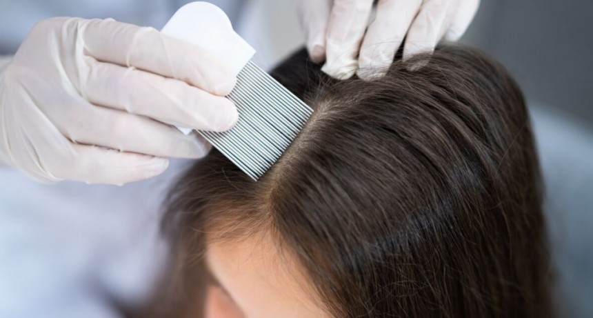 Madre no mata los piojos de su hija porque es vegana