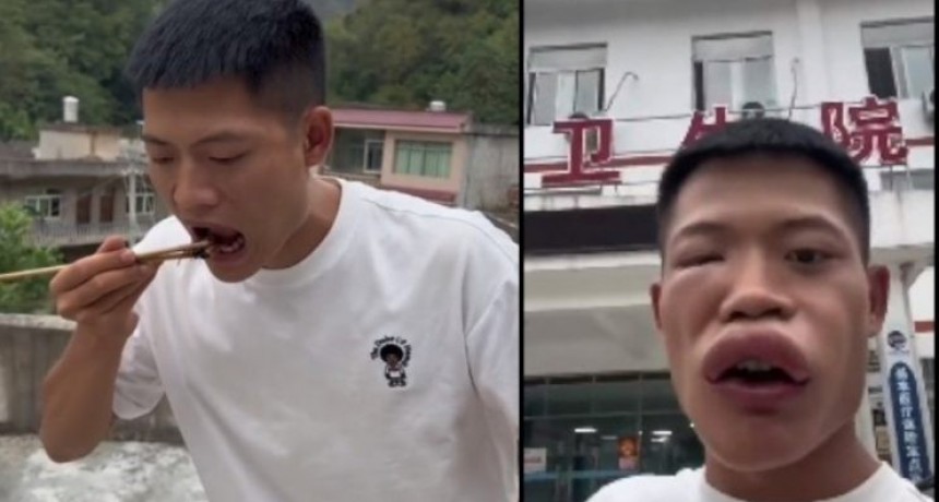 Chino qued&oacute; con la cara desfigurada por comerse una avispa 